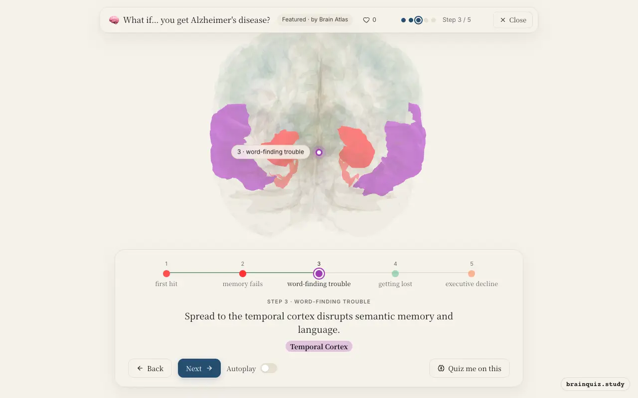 Step 3 of what happens in your brain when you get Alzheimer's disease: Entorhinal Cortex, Hippocampus, Temporal Cortex lit on the Brain Atlas 3D brain