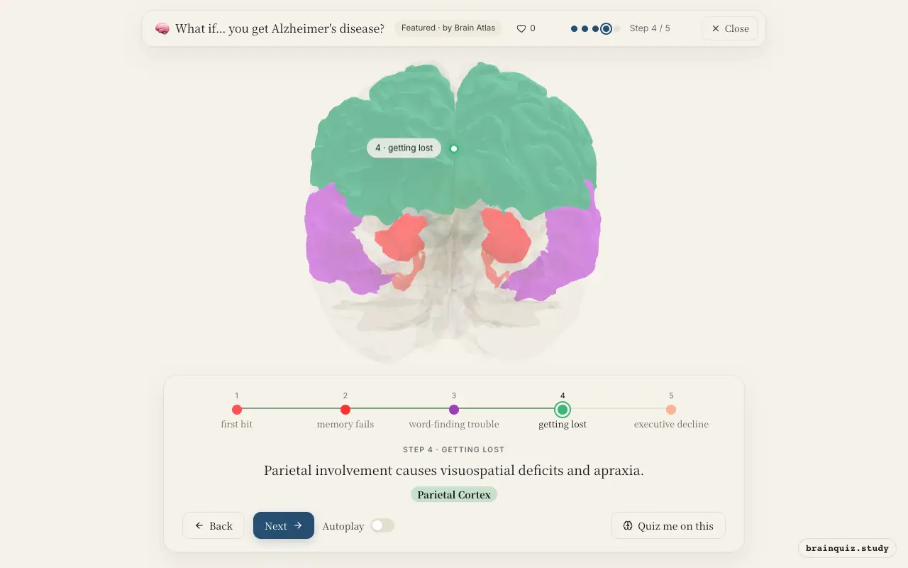 Step 4 of what happens in your brain when you get Alzheimer's disease: Entorhinal Cortex, Hippocampus, Temporal Cortex, Parietal Cortex lit on the Brain Atlas 3D brain