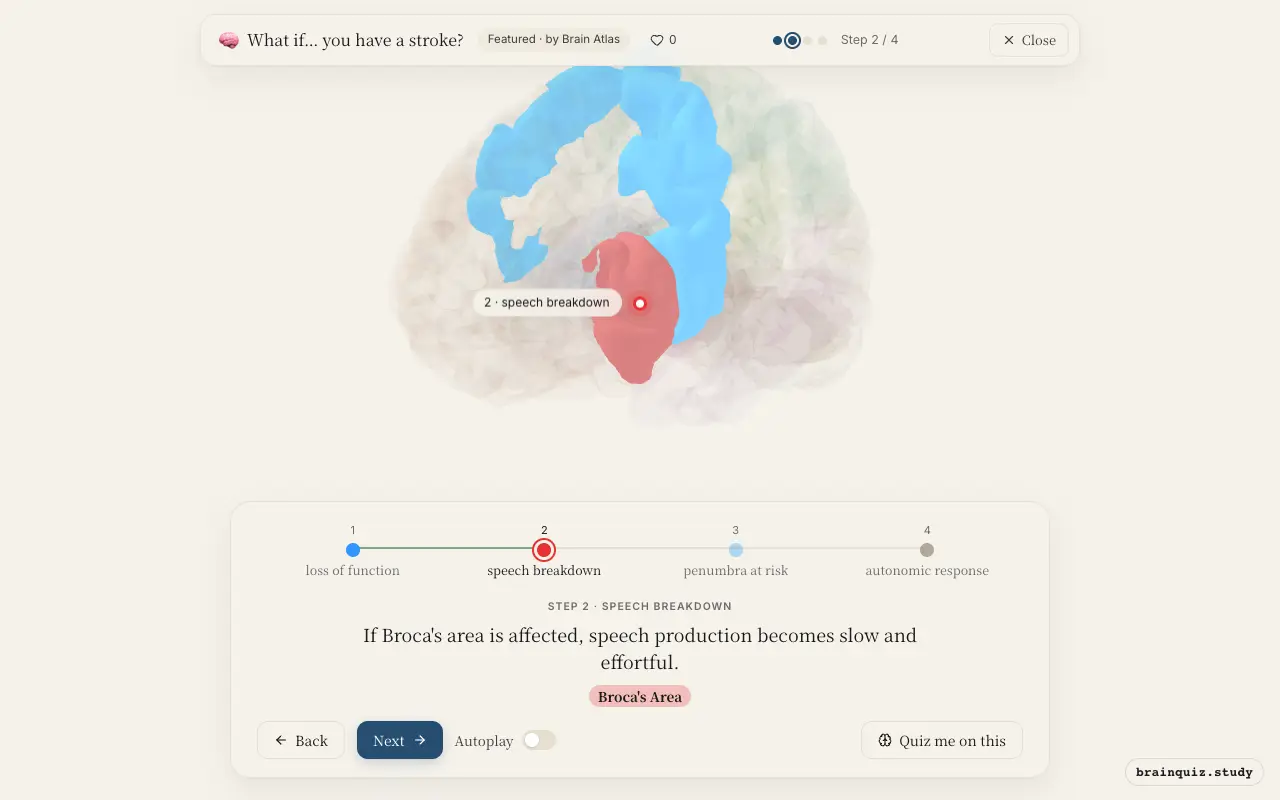 Step 2 of what happens in your brain when you have a stroke: Motor Cortex, Broca's Area lit on the Brain Atlas 3D brain